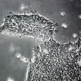 Phát hiện virus khiến con người bị ngớ ngẩn