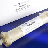 Cứu sống bác sĩ nhiễm Ebola bằng thiết bị lọc máu như chạy thận