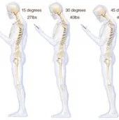 Nguy hiểm khôn lường khi cúi đầu dùng điện thoại