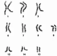 Thuốc lá làm tiêu hủy nhiễm sắc thể Y ở đàn ông
