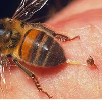 Cách xử lý khi bị ong đốt