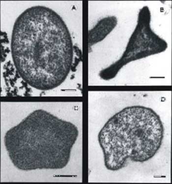 Vi khuẩn có thể sống ở nhiệt độ 121 độ C?