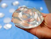 Phát hiện một số bệnh ung thư vú liên quan tới nâng ngực silicone