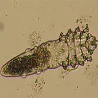 Demodex - Loài rận chuyên ký sinh trên... da mặt người