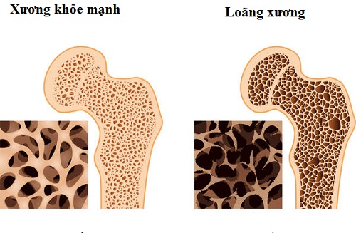 Mỹ tái tạo thành công xương từ tế bào gốc