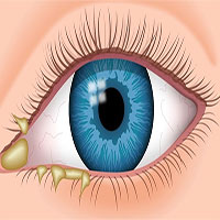 Các bệnh dễ mắc khi bơi lội và biện pháp phòng tránh