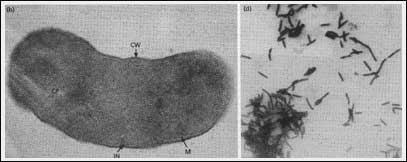 Khuẩn mêtan (Methanobacterium) - Nguồn khí đốt dưới đáy nước
