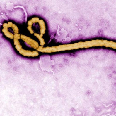 Thế giới bất lực trước dịch Ebola vì... sex