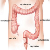 Ung thư đại trực tràng: Triệu chứng, nguyên nhân và cách phòng tránh