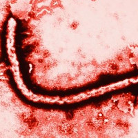 Người bệnh Ebola chưa hề khỏi, virus Ebola đã đánh lừa tất cả chúng ta