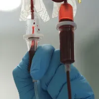 Phát hiện chủng virus "anh em" của virus viêm gan C