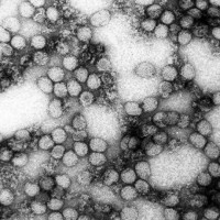 Tìm hiểu loại virus Zika 