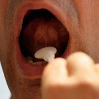 Chẩn đoán ung thư trong 10 phút qua nước bọt