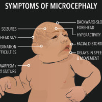 Virus Zika hoành hành trong lịch sử nhân loại như thế nào?