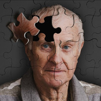 Bệnh nhân đầu tiên mang virus HIV sống lâu đến mức bị mắc Alzheimer