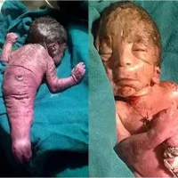 "Người cá" thứ tư thế giới ra đời