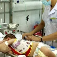 Cảnh báo viêm não cấp với virus Coxsackie
