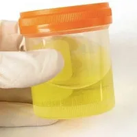 13 điều thú vị bất ngờ về nước tiểu