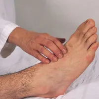 Hướng dẫn cách tự kiểm tra xem mạch máu có bị tắc hay không