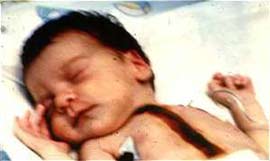 Cấy ghép cơ quan giữa các loài