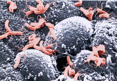 Giải Nobel y sinh học năm 2005 - Một cõi đi về với vi khuẩn