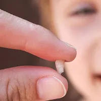Điều cần biết về chuyện "giữ răng sữa để cứu mạng con"