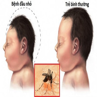 Virus Zika lan rộng 16 quận huyện Sài Gòn