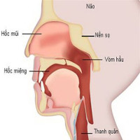 Cách nhận biết sớm các loại ung thư đầu cổ