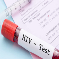 Tìm ra phương pháp xét nghiệm HIV mới cho kết quả nhanh nhất