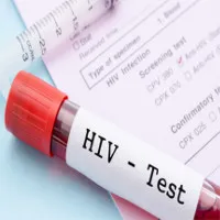 Tìm ra phương pháp xét nghiệm HIV mới cho kết quả nhanh nhất