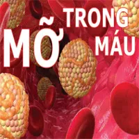 Những tác hại của máu nhiễm mỡ cực kỳ nguy hiểm