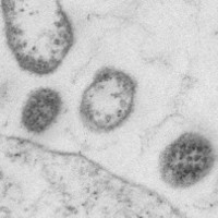 Khoa học chế ra virus giết chết tế bào ung thư, bước ngoặt lớn của nhân loại?