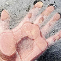 Cô gái hồi sinh sau một đêm bị đóng băng khiến y học không thể lý giải