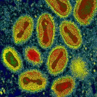 Nhà khoa học Canada "hồi sinh" virus đã tuyệt chủng từng giết hại 500 triệu người