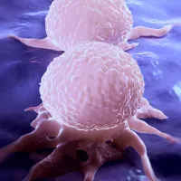 Bệnh nhân ung thư vú có thể tránh "ác mộng" di căn nhờ phát hiện mới