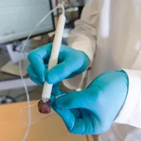 Chiếc bút phát hiện ung thư trong 10 giây