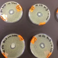 Nghiên cứu mới: Sữa mẹ có khả năng giết chết mọi loại vi khuẩn