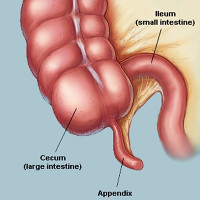 Tác dụng của ruột thừa là gì?