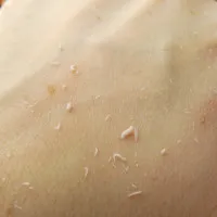 Vì sao ngày nào cũng tắm sạch rồi mà kì nhẹ thôi cũng ra ghét?