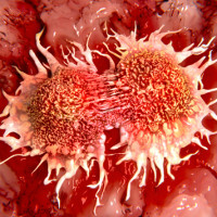 Các nhà khoa học Nga và Thụy Điển tìm ra cách diệt tế bào ung thư