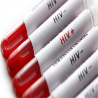 Phát hiện thuốc điều trị ung thư phổi có thể tiêu diệt các tế bào HIV