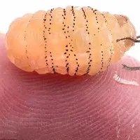 Video: Cận cảnh màn gắp ấu trùng ruồi trâu kinh dị trên vai cô gái thu hút triệu người xem