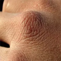 500 triệu tế bào da đào thải mỗi ngày nhưng vì sao máu, chất dịch cơ thể không rò rỉ qua da?