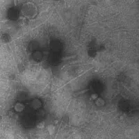 Hàng tỉ con virus đang rơi vào đầu chúng ta mỗi ngày mà chẳng ai hay biết