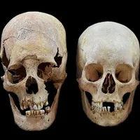 Vì sao phụ nữ Trung cổ có hộp sọ giống người ngoài hành tinh?
