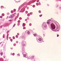 Tìm ra loại virus có thể giúp tăng cường miễn dịch cho người cao tuổi