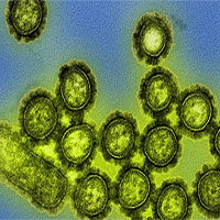 Ngày càng nhiều virus chết người lan ra khắp thế giới, và lý do thật chẳng dễ chịu chút nào