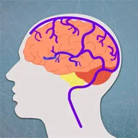 "Đông não" - hiện tượng tưởng lạ nhưng khối người đã từng trải qua