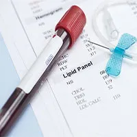 Cholesterol "tốt" có thể ảnh hưởng xấu đến một số người