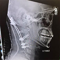 Chàng trai 22 tuổi gây chấn động y học vì sống sót sau tai nạn 